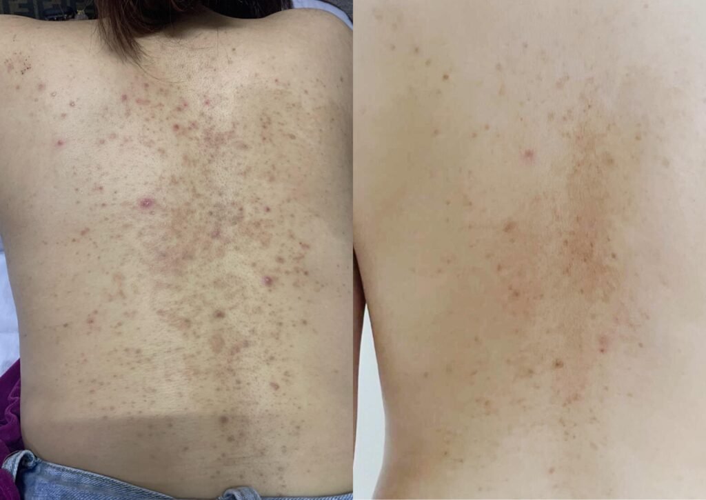 SKS Mall Back Care Recommendation